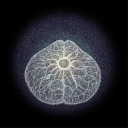 'Transcendental Awareness' arises After Dis-identification: Who sees my 'Self' in the Consciousness of Void?