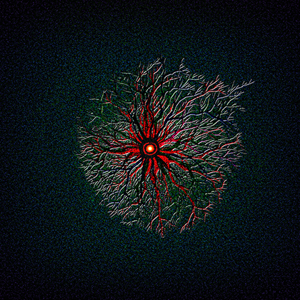 Self-Destruction: 'Rotten Mental-Synapse' of Addiction
